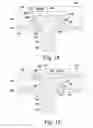 Fig. 09 - Mechanical assembly of pegs to prosthesis