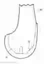Fig. 01 - Low profile knee implant
