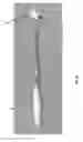 Fig. 02 - Acetabular fixation system and method