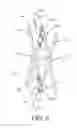 Fig. 06 - Articulated commissure valve stents and methods