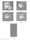 Fig. 09 - Implants with wear resistant coatings and methods
