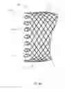 Fig. 07 - Esophageal stent