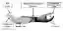 Fig. 01 - FITTING SYSTEM FOR A NEURAL ENABLED LIMB PROSTHESIS SYSTEM
