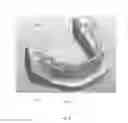 Fig. 07 - Customized dental impression tray