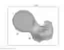 Fig. 01 - Systems and methods for using generic anatomy models in surgical planning