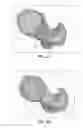Fig. 03 - Systems and methods for using generic anatomy models in surgical planning