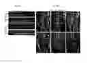 Fig. 11 - In vivo cellular screening methods and compositions for modeling and treating nervous system dysfunction