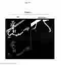 Fig. 16 - In vivo cellular screening methods and compositions for modeling and treating nervous system dysfunction