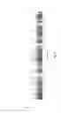Fig. 10 - Compositions and methods for diagnosis of genetic susceptibility, resistance, or tolerance to infection by mycobacteria and bovine paratuberculosis using promoter variants of EDN2