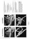 Fig. 04 - Genetically modified mouse with an inducible gene with a mutant R206H exon 5 that has ectopic bone formation