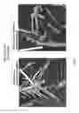 Fig. 09 - Genetically modified mouse with an inducible gene with a mutant R206H exon 5 that has ectopic bone formation
