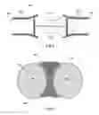 Fig. 04 - Protective garment with scissor deflecting and jamming obstacles
