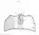 Fig. 24 - Cold Weather Exposure Mask