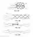 Fig. 03 - Methods and devices for crimping self-expanding devices