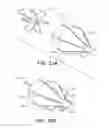 Fig. 10 - Methods and devices for crimping self-expanding devices