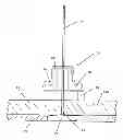 Fig. 01 - Tile alignment and leveling device