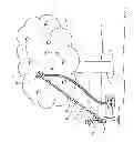 Fig. 02 - Apple and Fruit Harvester