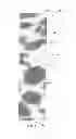 Fig. 02 - KNITTING FABRIC AND METHOD OF USE