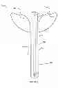 Fig. 04 - Luggage Locking Apparatus and Method