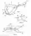 Fig. 02 - Crossbow Cocking Device