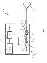 Fig. 02 - Therapeutic gas delivery device with pulsed and continuous flow control