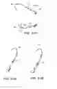Fig. 25 - Nasal mask system