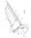 Fig. 02 - Device for maintaining a patient in a position and methods of using it