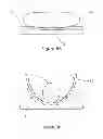 Fig. 08 - Device for maintaining a patient in a position and methods of using it