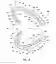 Fig. 02 - Oral appliance system