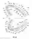 Fig. 06 - Oral appliance system