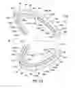 Fig. 22 - Oral appliance system