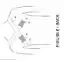 Fig. 09 - Implanted IV port protection device