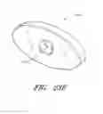Fig. 41 - Body-inserted tube cleaning