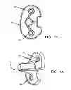 Fig. 02 - Systems and Methods for Undercut Features on Injected Patterns