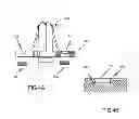 Fig. 08 - Systems and Methods for Undercut Features on Injected Patterns