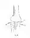 Fig. 09 - Systems and Methods for Undercut Features on Injected Patterns