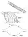 Fig. 23 - Wellbore isolation tool using sealing element having shape memory polymer