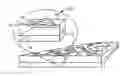 Fig. 01 - Patterned transparent conductors and related manufacturing methods