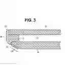 Fig. 04 - Radio frequency shielding system