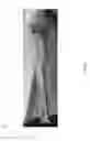 Fig. 04 - Rotatable Easel with Adjustable Arms