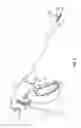Fig. 02 - Surgical tissue sealer