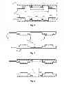 Fig. 03 - Actively shielded, cylindrical gradient coil system with passive RF shielding for NMR devices