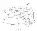 Fig. 04 - Structures for forming conductive paths in antennas and other electronic device structures