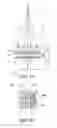 Fig. 16 - Microlens array unit and solid state imaging device