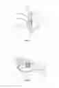 Fig. 02 - Ocular surface interferometry (OSI) devices and systems for imaging, processing, and/or displaying an ocular tear film
