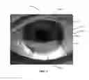 Fig. 08 - Ocular surface interferometry (OSI) devices and systems for imaging, processing, and/or displaying an ocular tear film