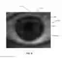 Fig. 09 - Ocular surface interferometry (OSI) devices and systems for imaging, processing, and/or displaying an ocular tear film