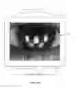 Fig. 35 - Ocular surface interferometry (OSI) devices and systems for imaging, processing, and/or displaying an ocular tear film