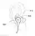 Fig. 01 - Earmolds
