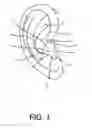 Fig. 02 - Earmolds